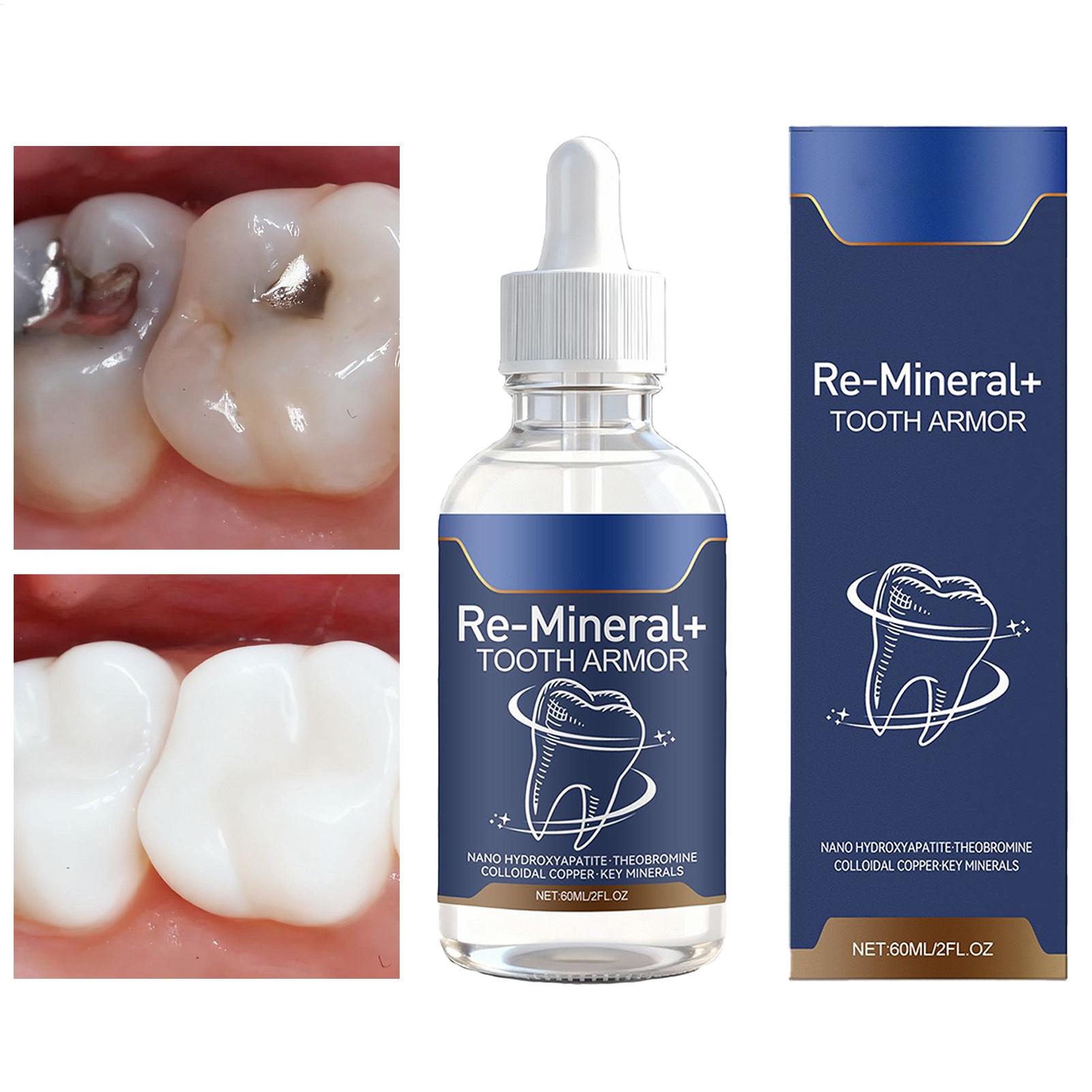 Teeth Whitening And Stain Removal - Liquido per la Pulizia dei Denti