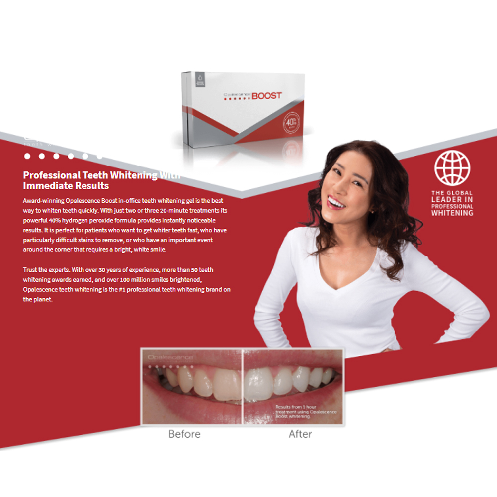 Opalescence Boost 40% PF Ameri - Teeth Whitening Opalescence recensione e prezzo