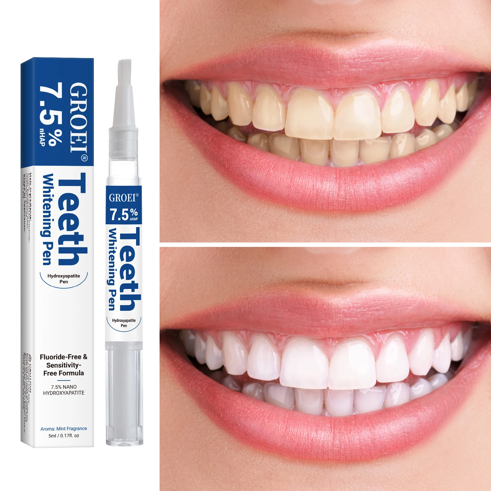 Penna per sbiancamento dei den - Teeth Whitening Q&M recensione e prezzo