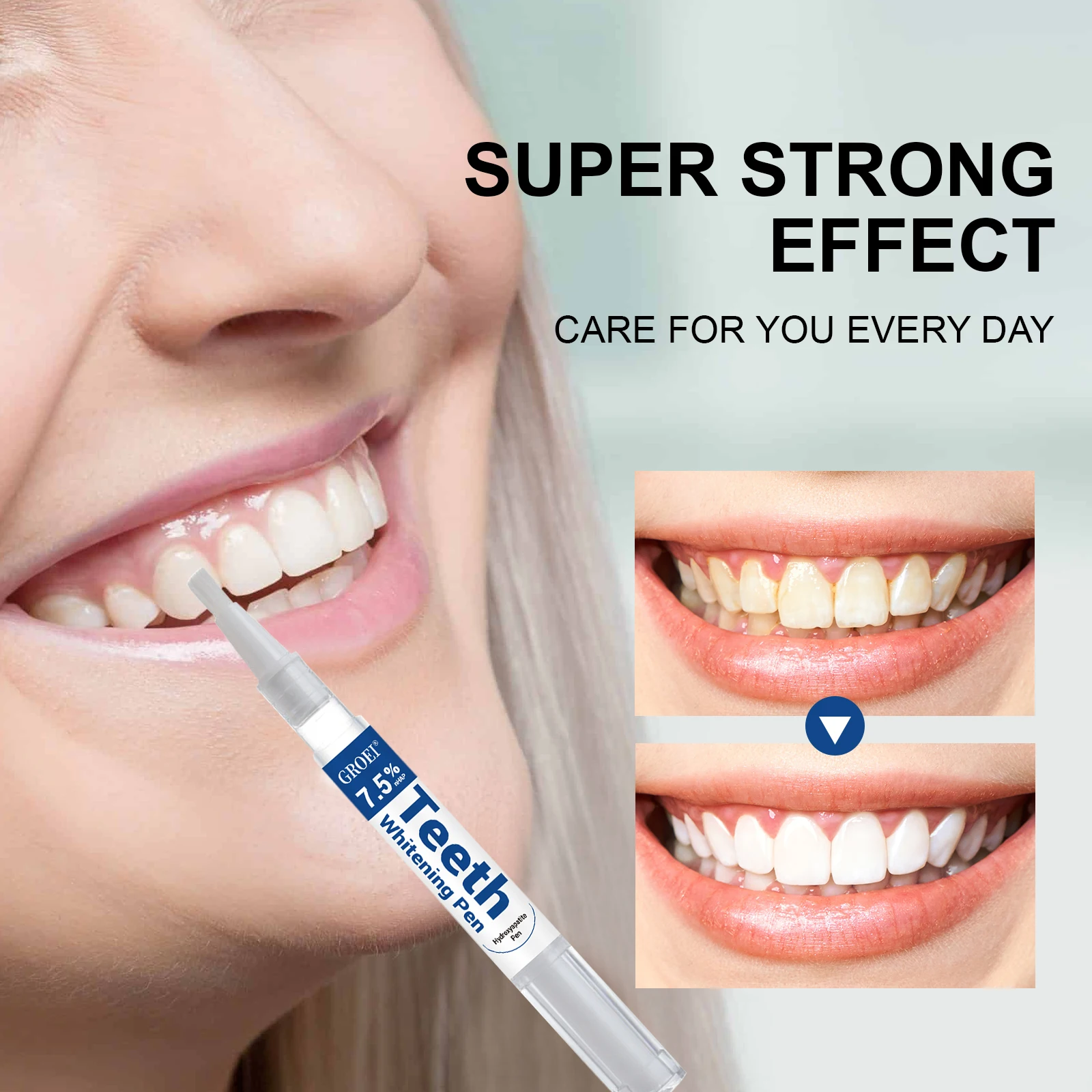 Penna per sbiancamento dei den - Teeth Whitening Q&M recensione e prezzo