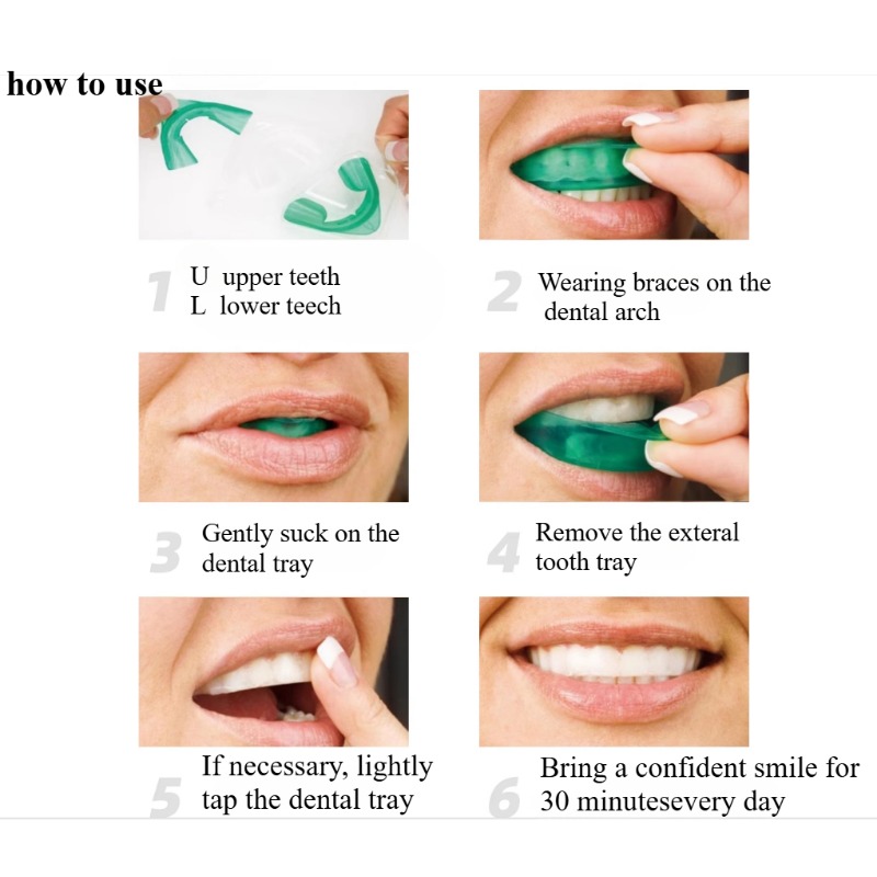Set Vassoio per sbiancamento d - Teeth Whitening Opalescence recensione e prezzo