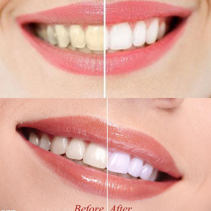 Denti di carbone di bambù dent - Teeth Whitening Charcoal Powder recensione e prezzo