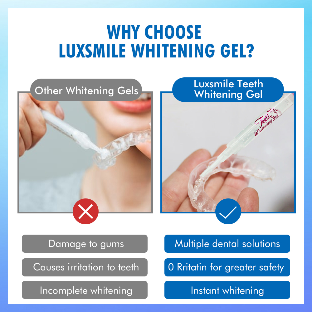 Gel sbiancante per denti PAP o - Teeth Whitening Q&M recensione e prezzo