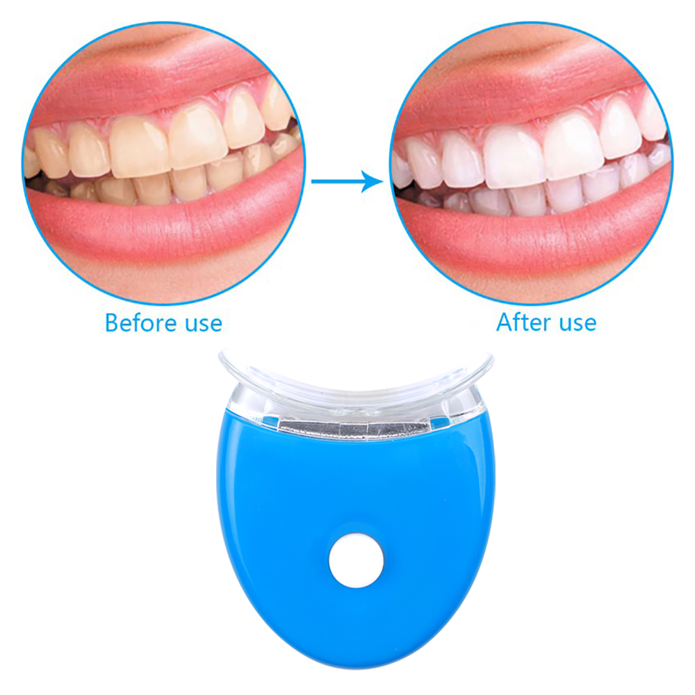 Kit gel sbiancante per denti I - Teeth Whitening Opalescence recensione e prezzo