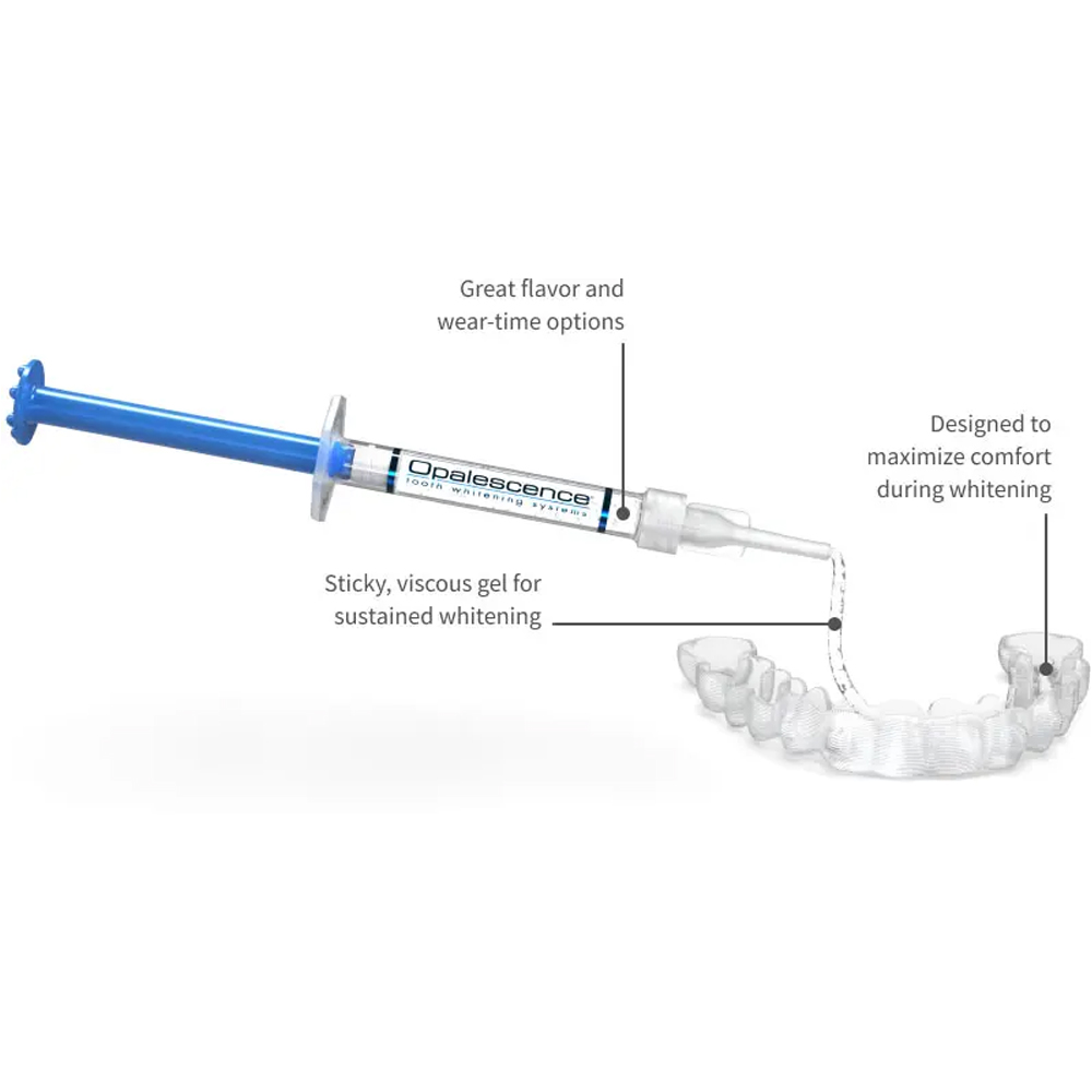 Kit sbiancante professionale O - Teeth Whitening Opalescence recensione e prezzo