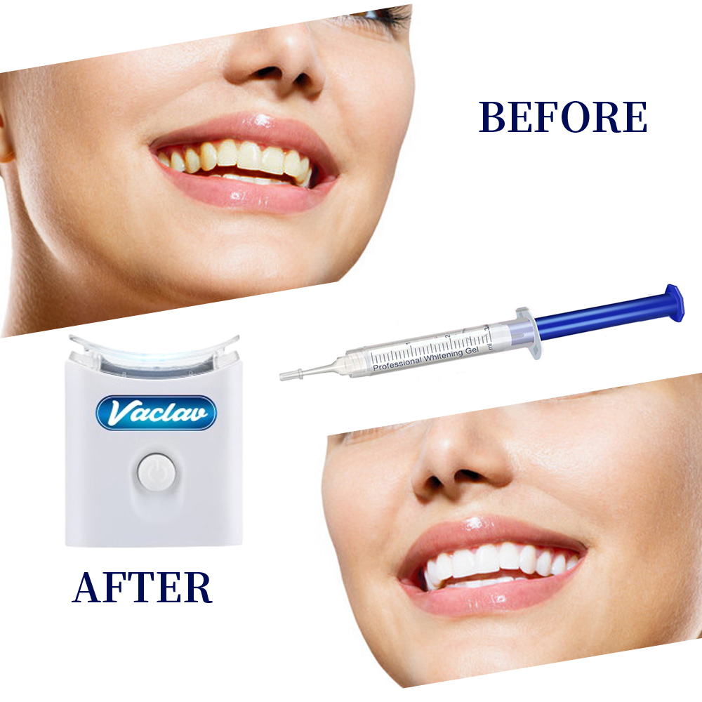 Menta Sbiancamento Dei Denti G - Teeth Whitening Opalescence recensione e prezzo