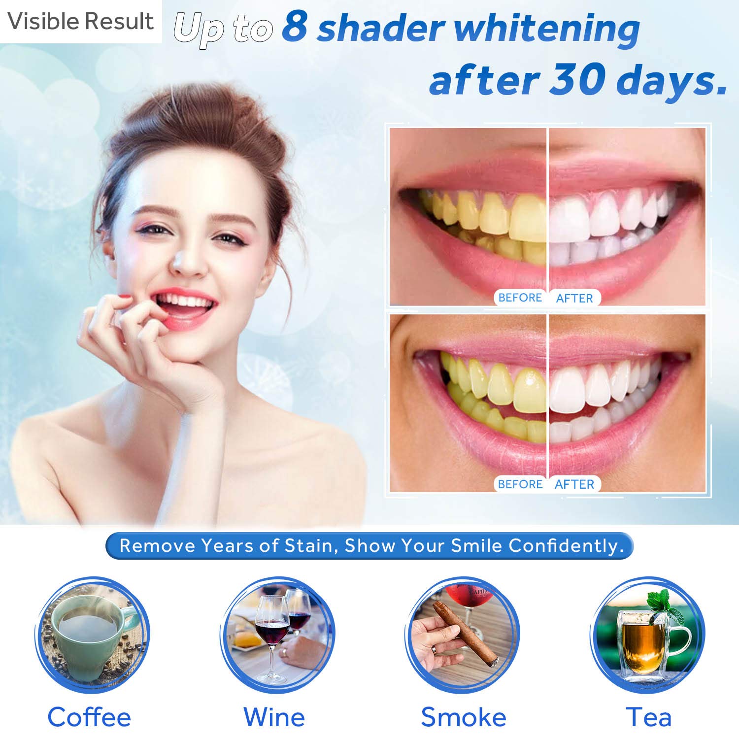 Gel sbiancante per denti Ricar - Teeth Whitening Q&M recensione e prezzo