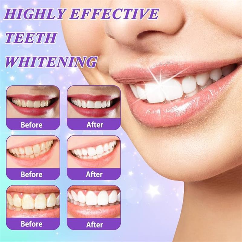 Dentifricio sbiancante 9D viol - Teeth Whitening Toothpaste recensione e prezzo