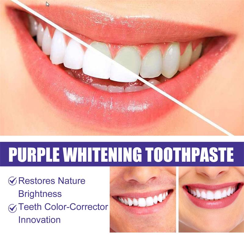 Dentifricio sbiancante 9D viol - Teeth Whitening Toothpaste recensione e prezzo
