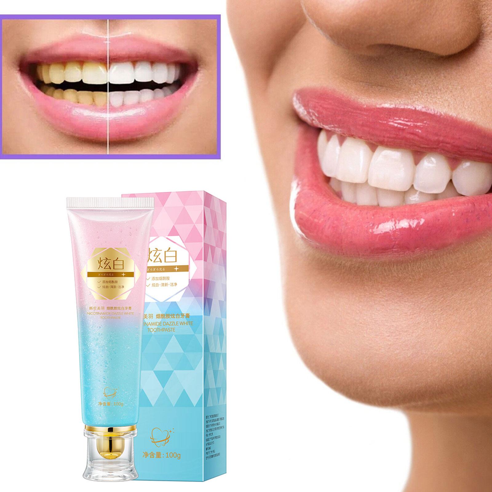 Dentifricio sbiancante al niac - Teeth Whitening Toothpaste recensione e prezzo
