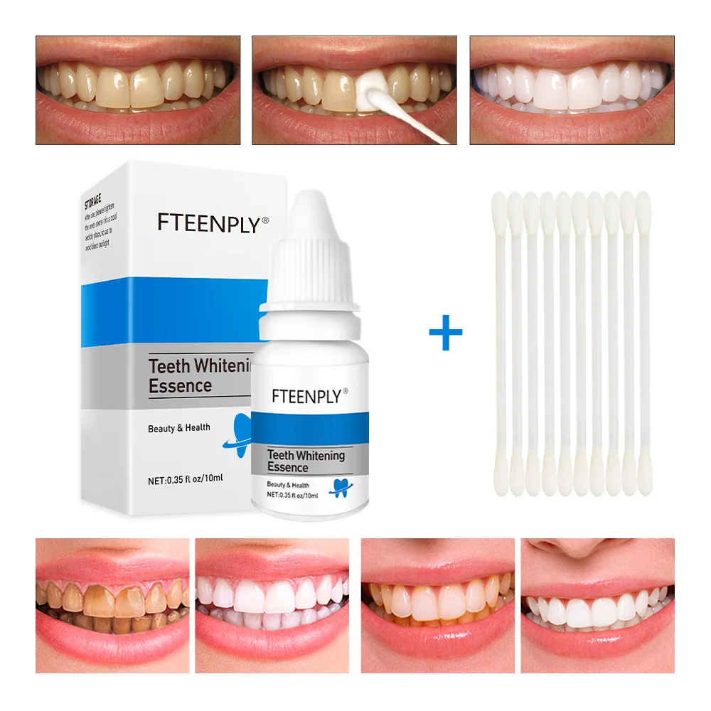 FTEENPLY Sbiancamento Dei Dent - Teeth Whitening Q&M recensione e prezzo