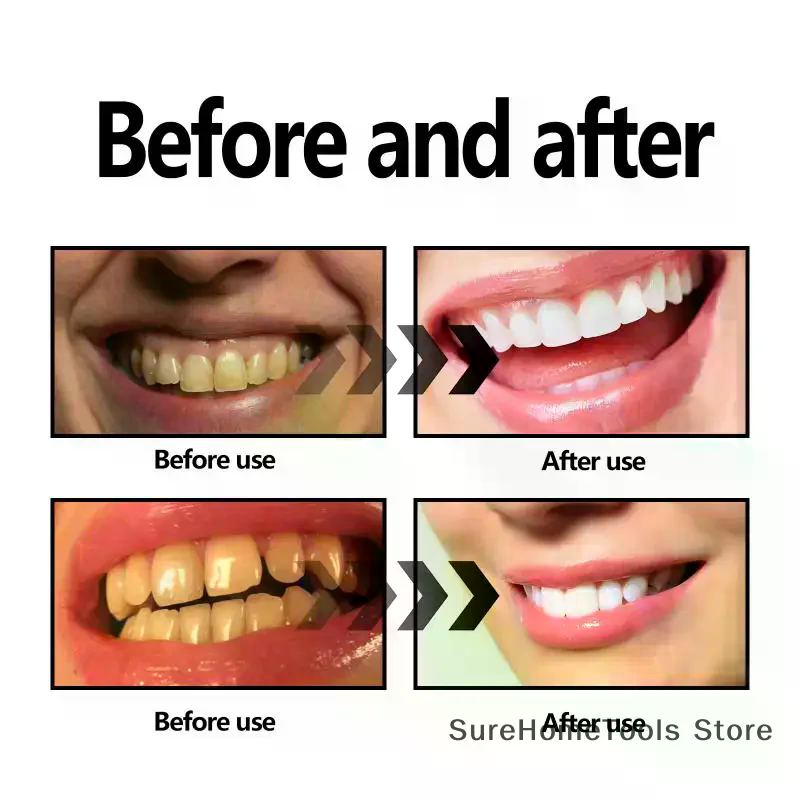 Polvere di carbone di bambù pe - Teeth Whitening Charcoal Powder recensione e prezzo