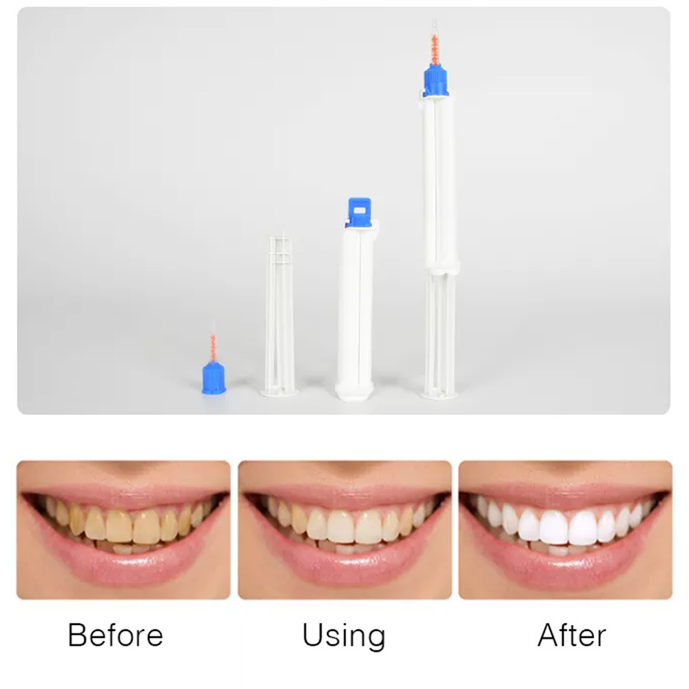10/5/2pcs Dentale Doppio Baril - Teeth Whitening Opalescence recensione e prezzo